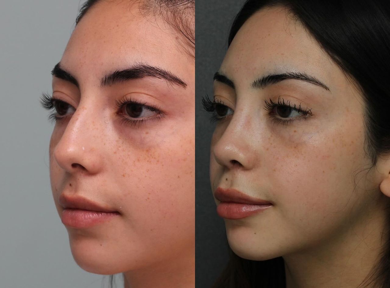 Angel Castro Urquizo-131