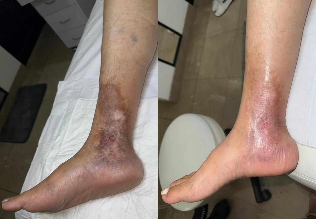 Jhonatan López González-70