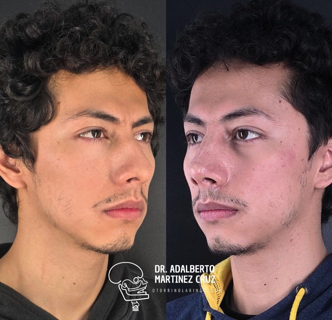 Adalberto Martínez Cruz-27