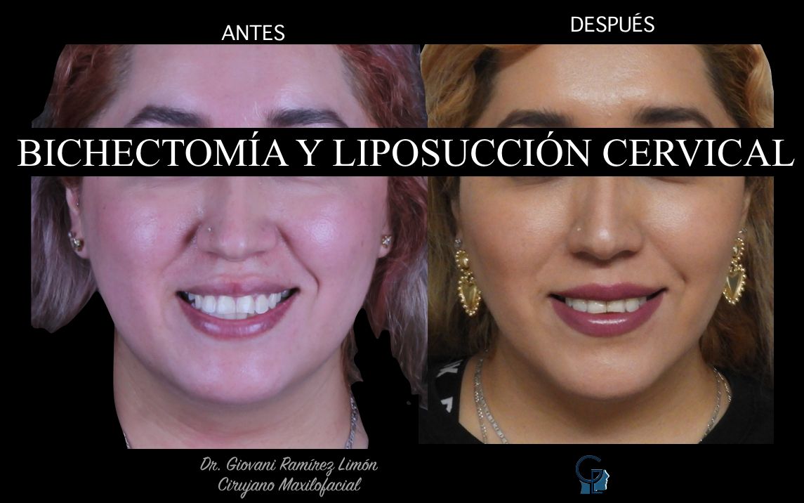 Giovani Ramírez Limón-18