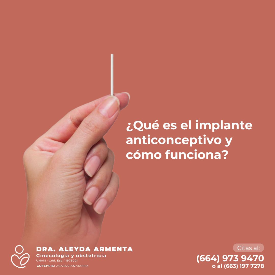 Aleyda Fernanda Armenta Rios-12