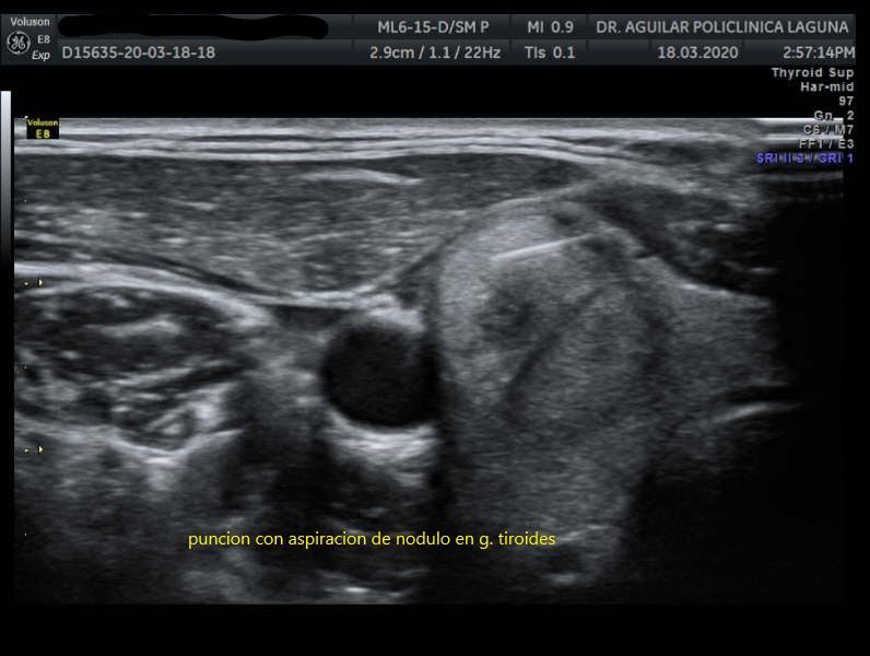 Edgar Fernando Aguilar Morales-8