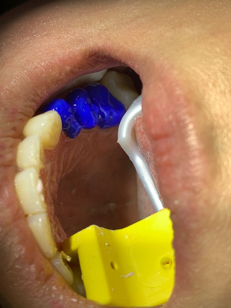 Yuriria Gochy Escalante-3