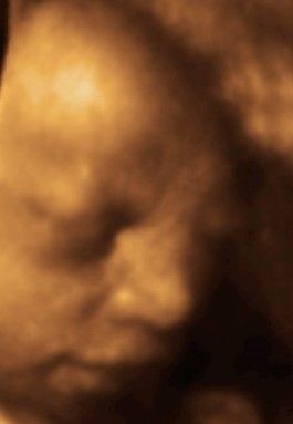 Manuel Pérez Morales-15