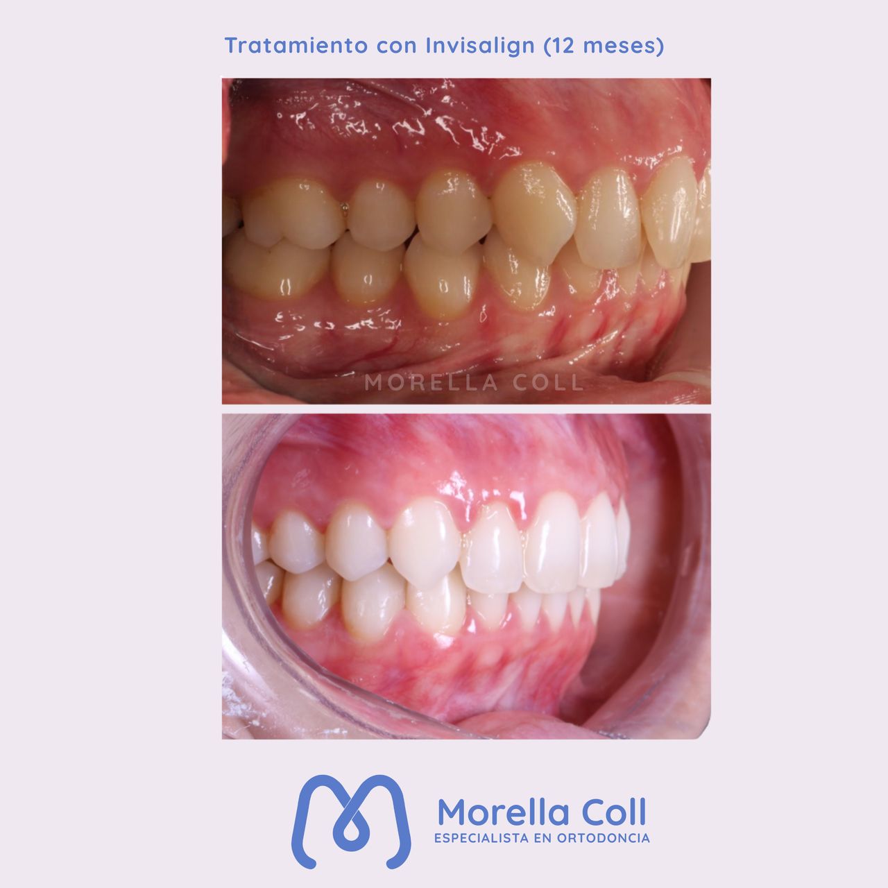 Morella Coll Mibelli-14