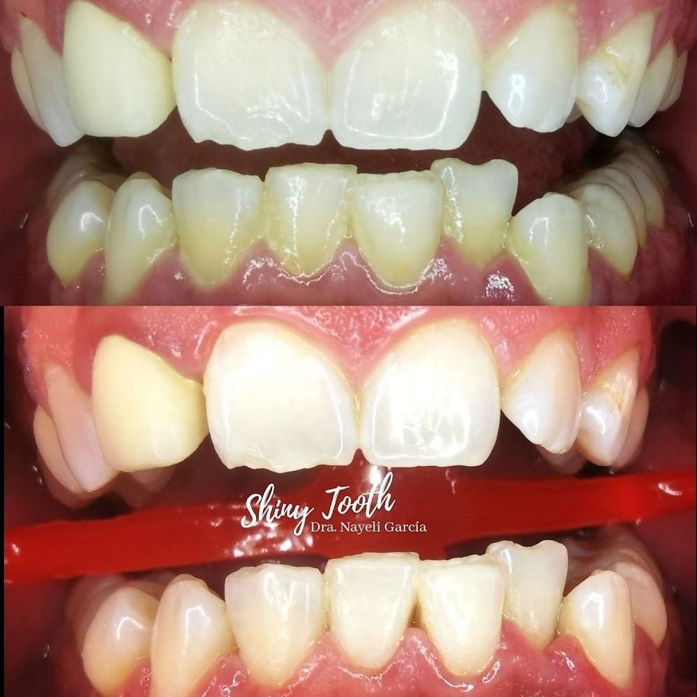 Nayeli Garcia Morales-39