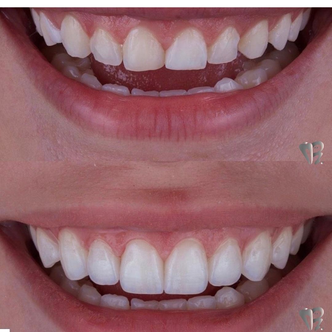 Ernesto Rojas Calderon-46