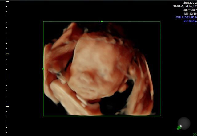 Graciela Elizabeth De La Torre Alvarez-28