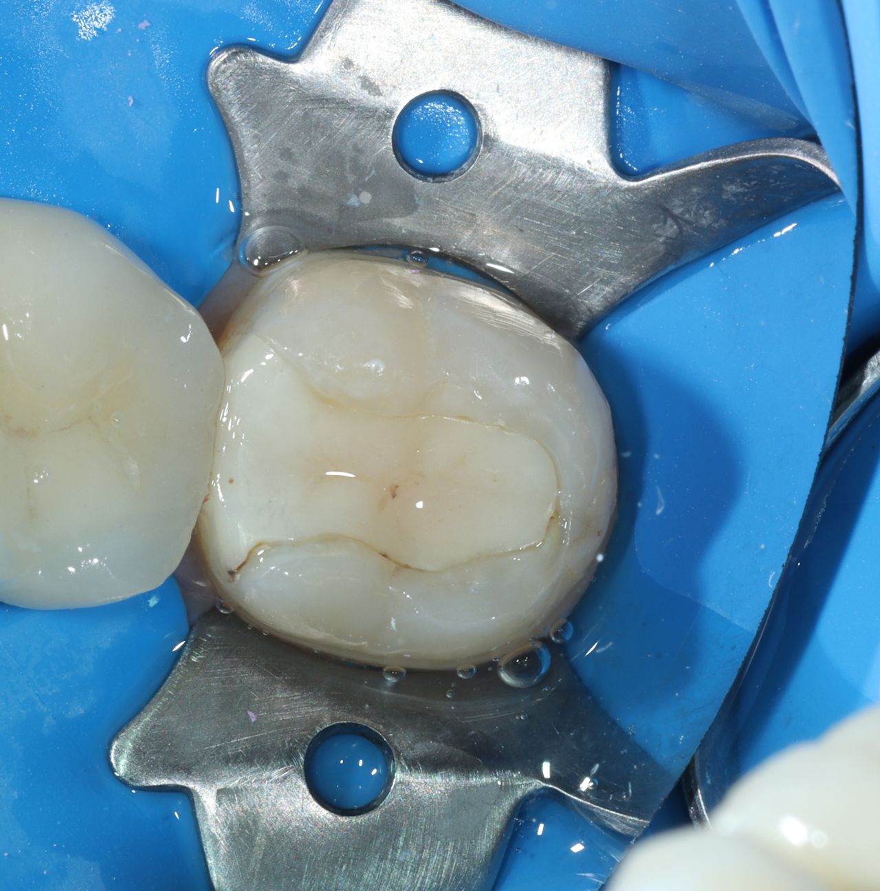 Uiquixu Flores Castro-11