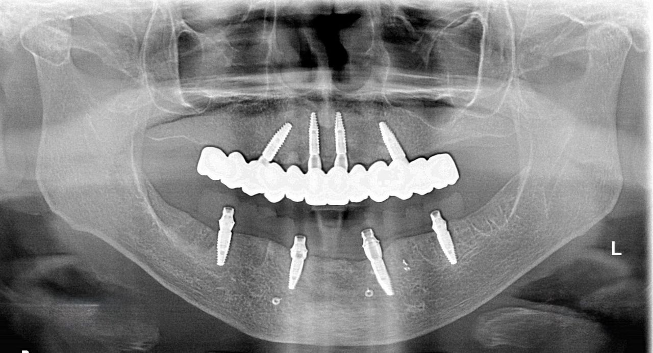 Sergio Cortes Peral-4