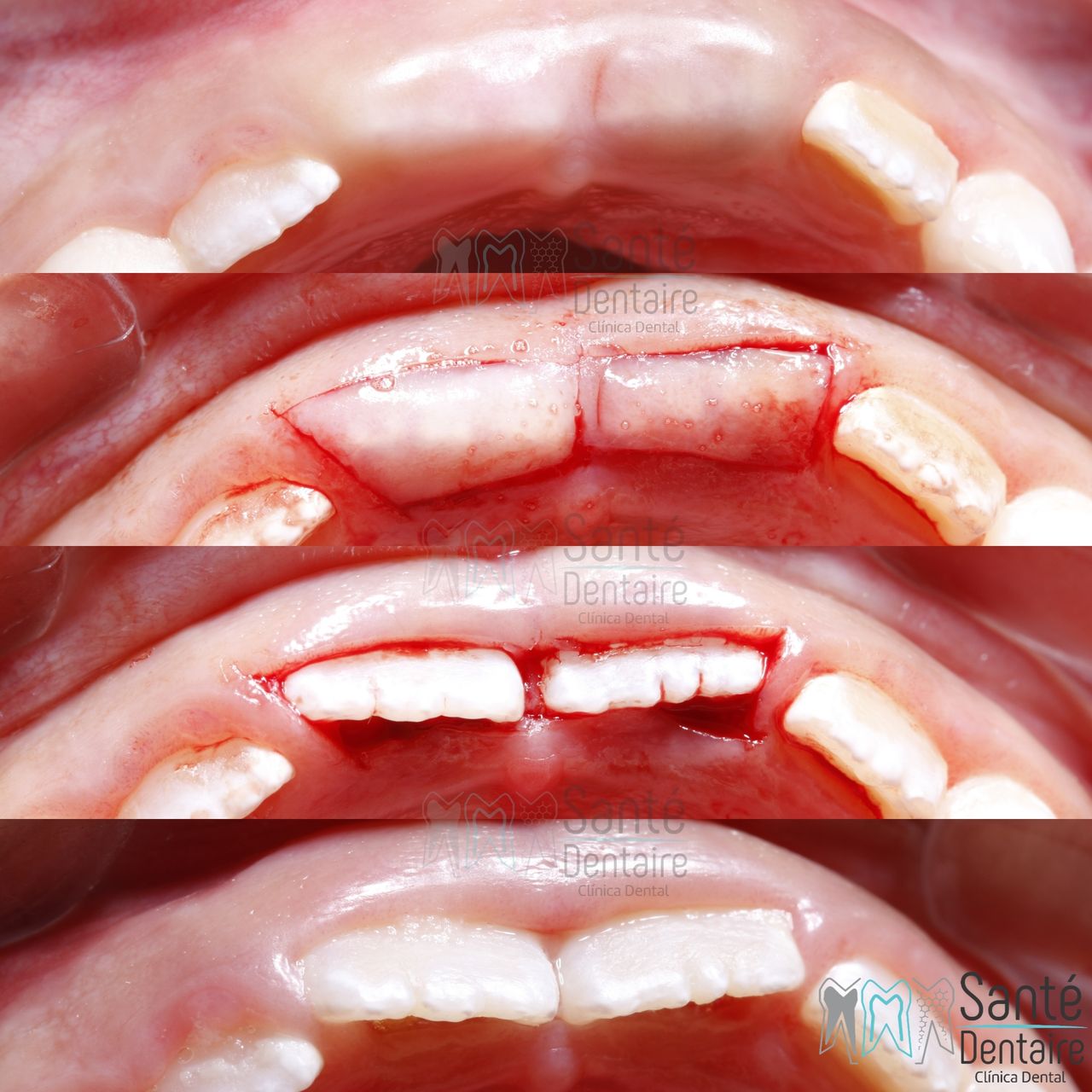 Daniel Oñate Robledo-14