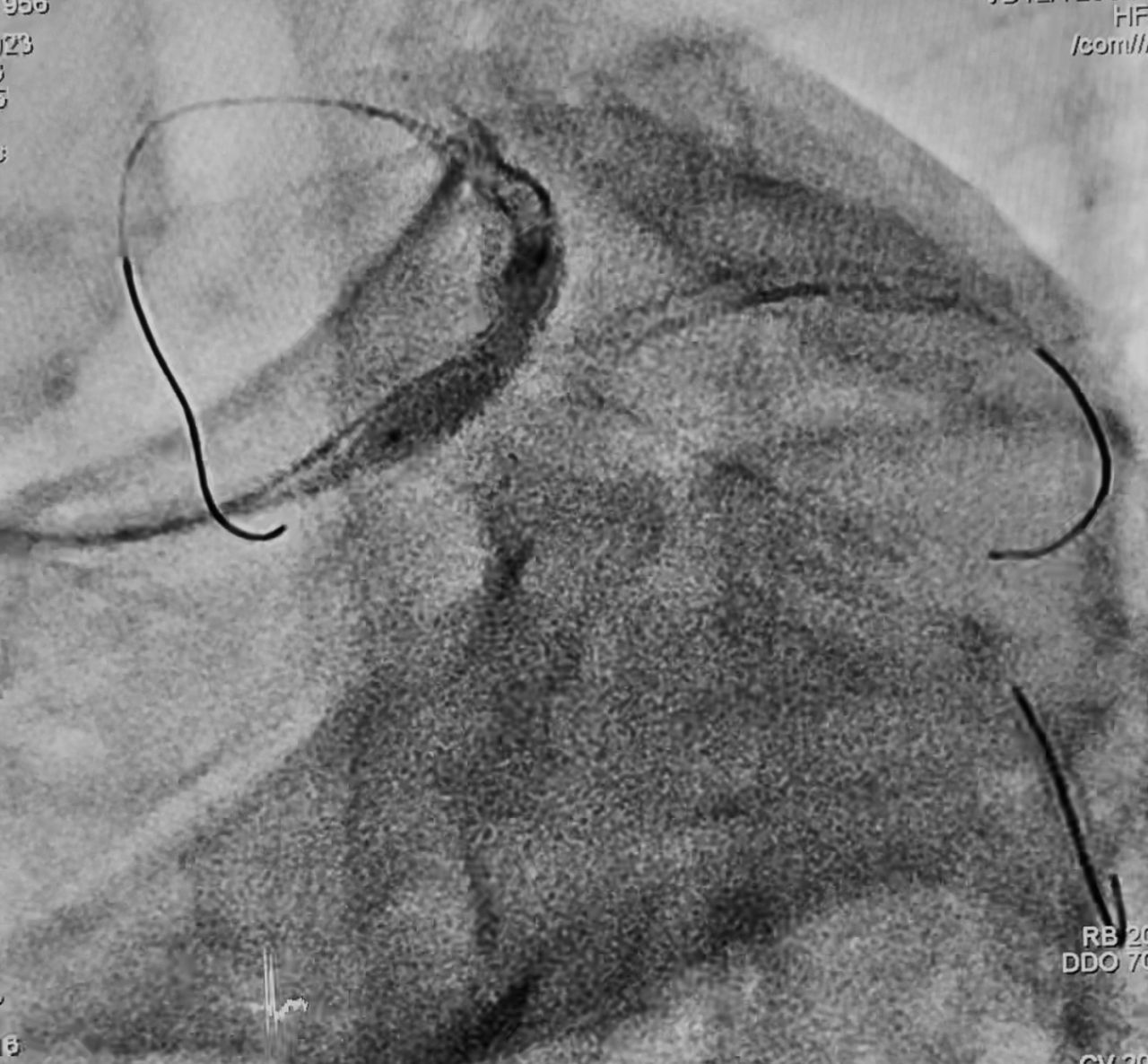 Abdón Ávila Chávez-4