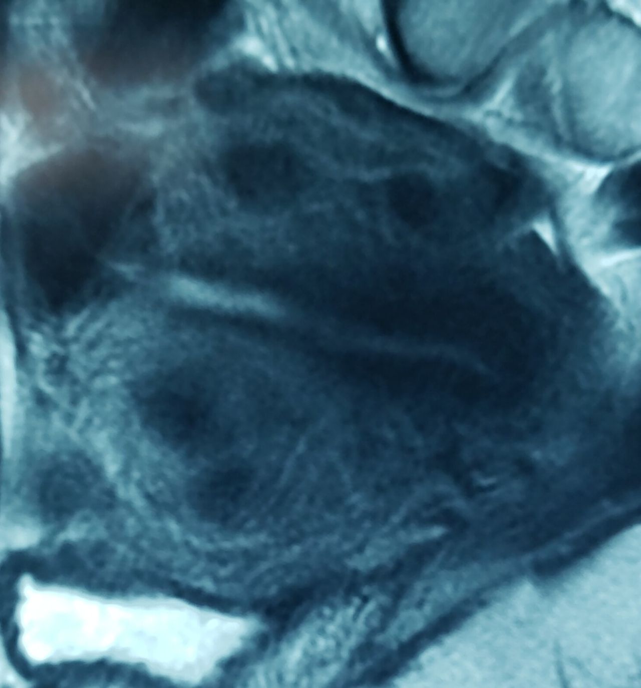 Germán Gabriel Palacios López-30