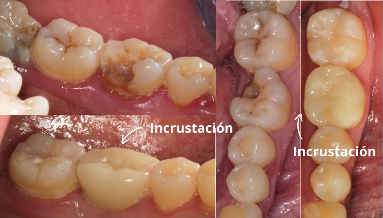 Karla Yaneth Garza Medina-0