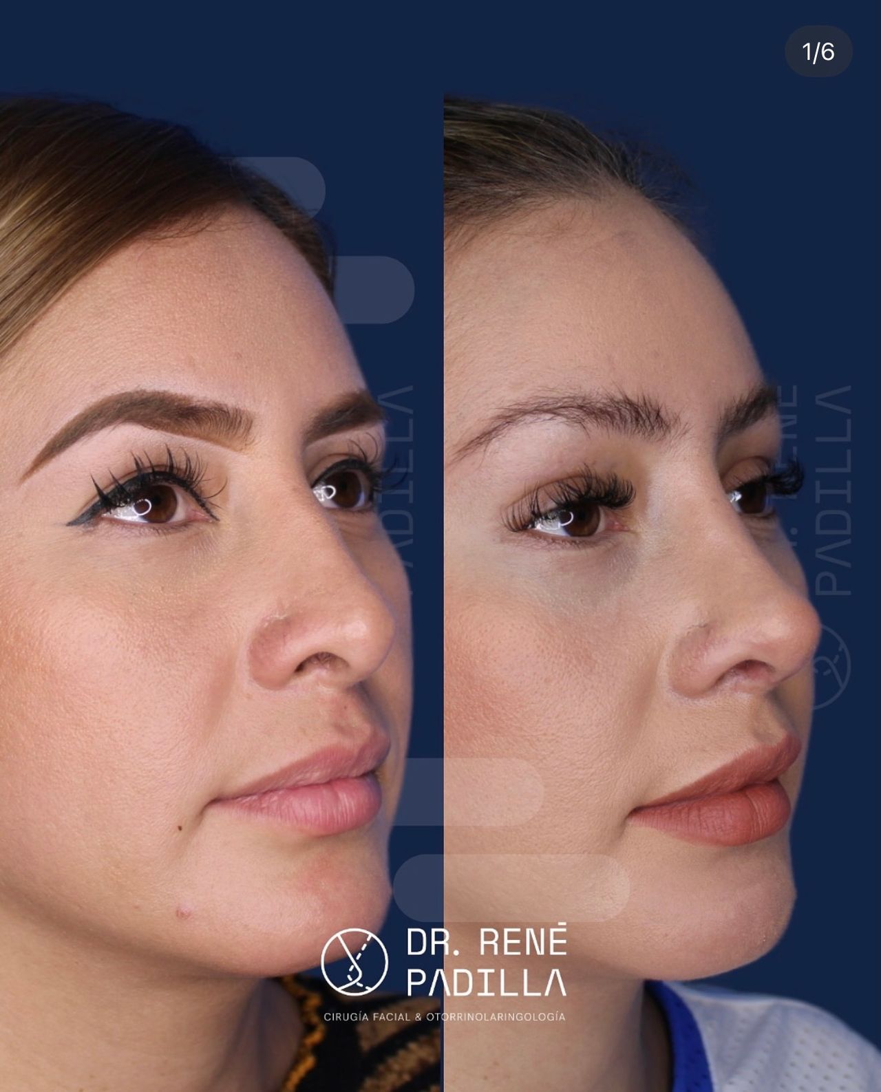 René Emmanuel Padilla López-16