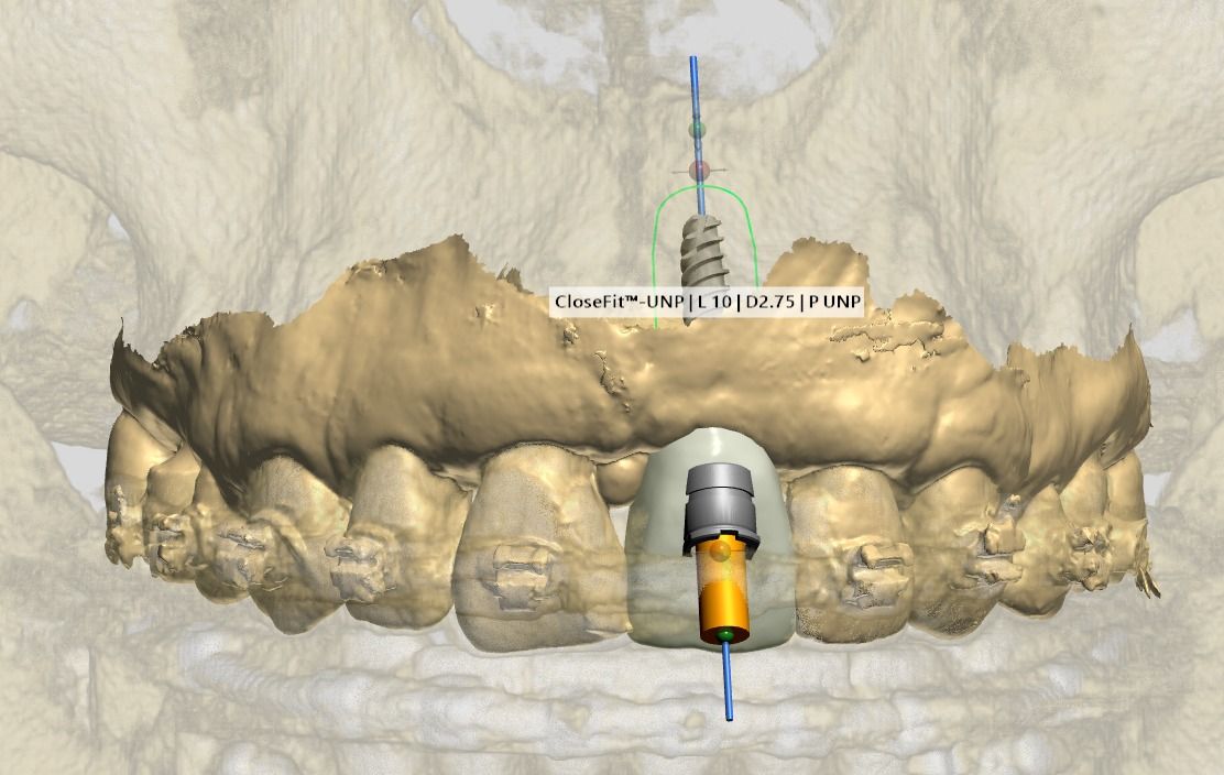 Ireri García Santana-4