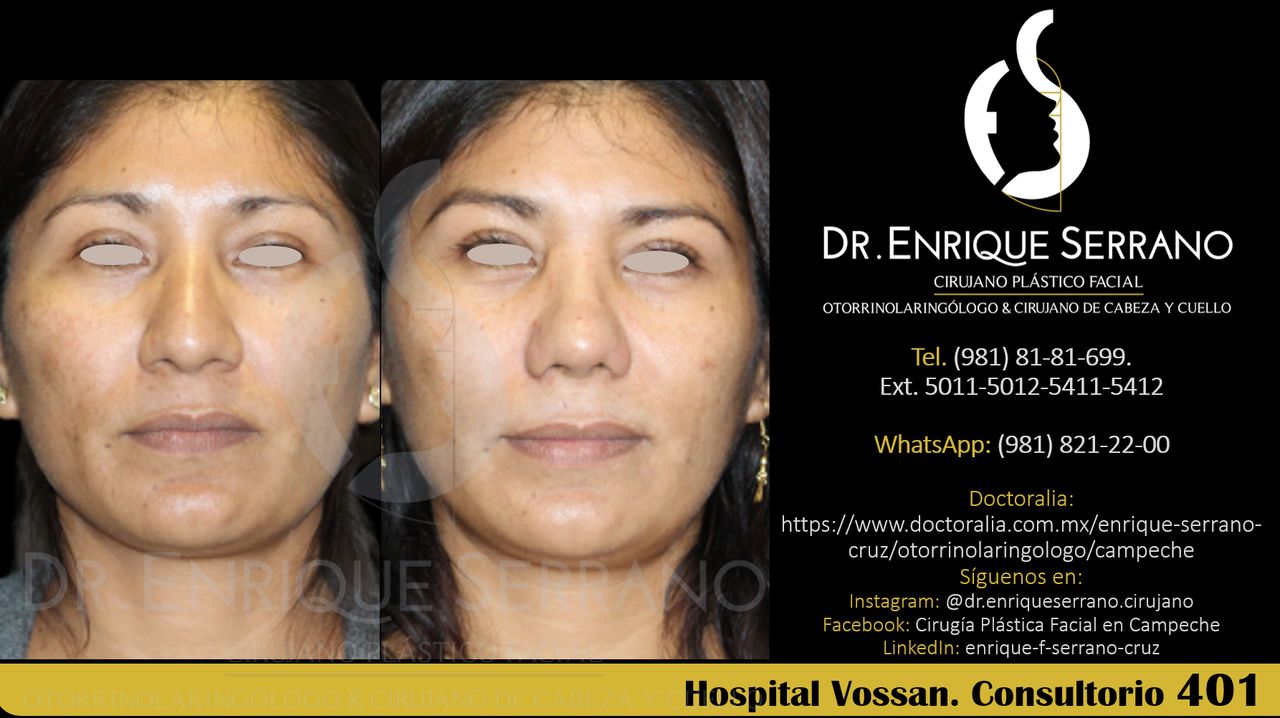 Enrique Serrano Cruz-90