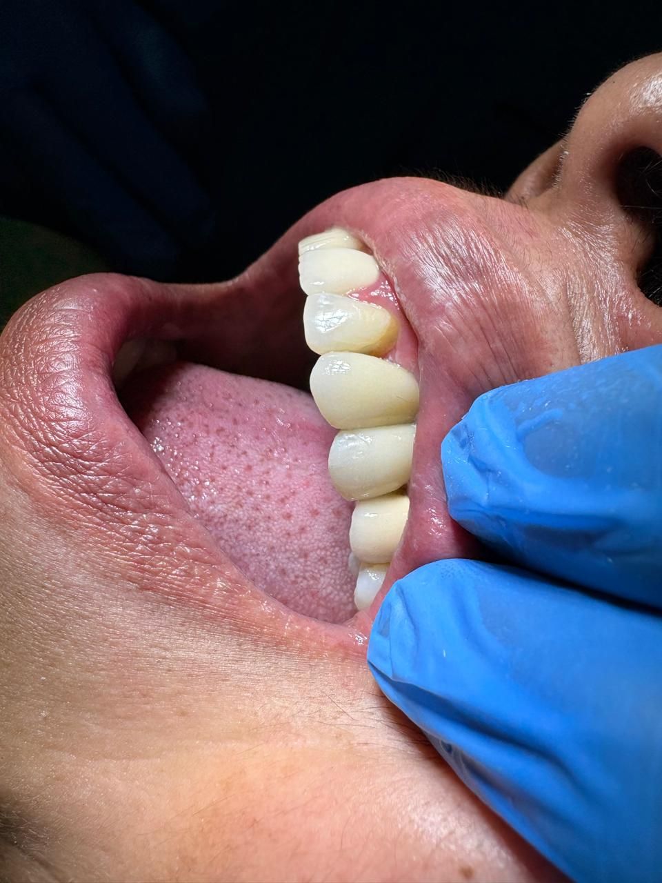 Arturo Romero Grande-40