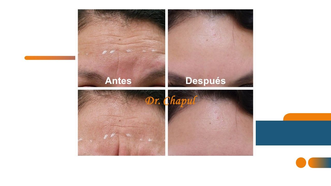 José Luis Muñoz Chapul-23