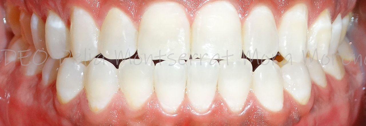 Delia Montserrat Mora Moreno-4