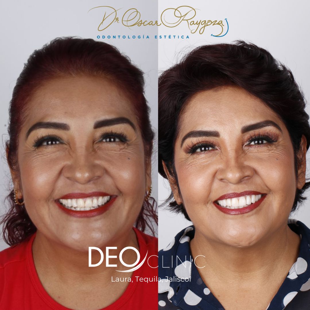 Oscar Raygoza Carrillo-38