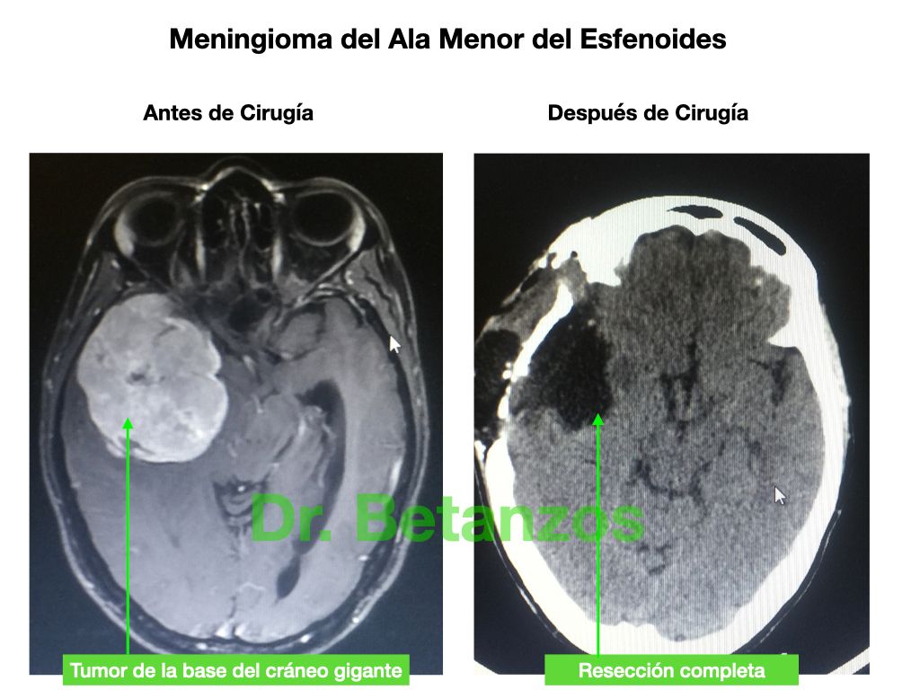 Aleixandre Betanzos Villegas-6