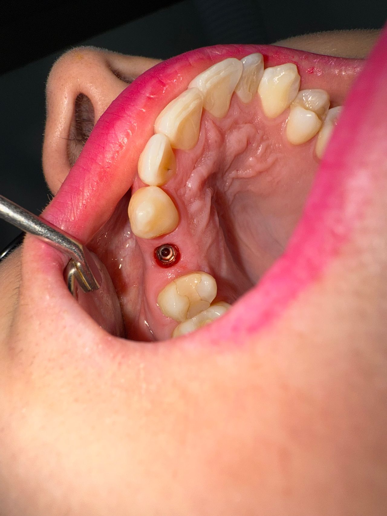 Jair Contreras García-66