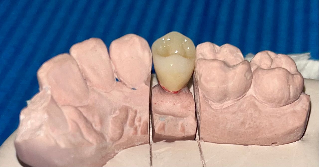 María Elena Merino Calderón-5