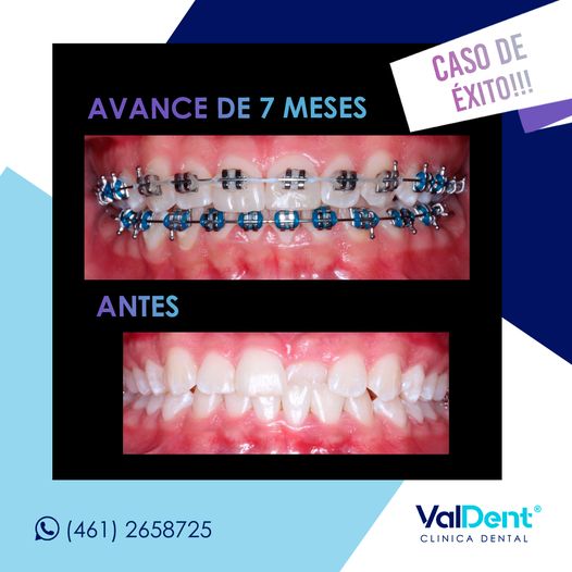 Karla Valdespino Gutierrez-8