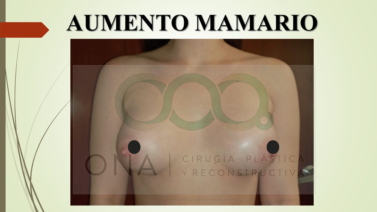 José Luis Segura Castillo-9