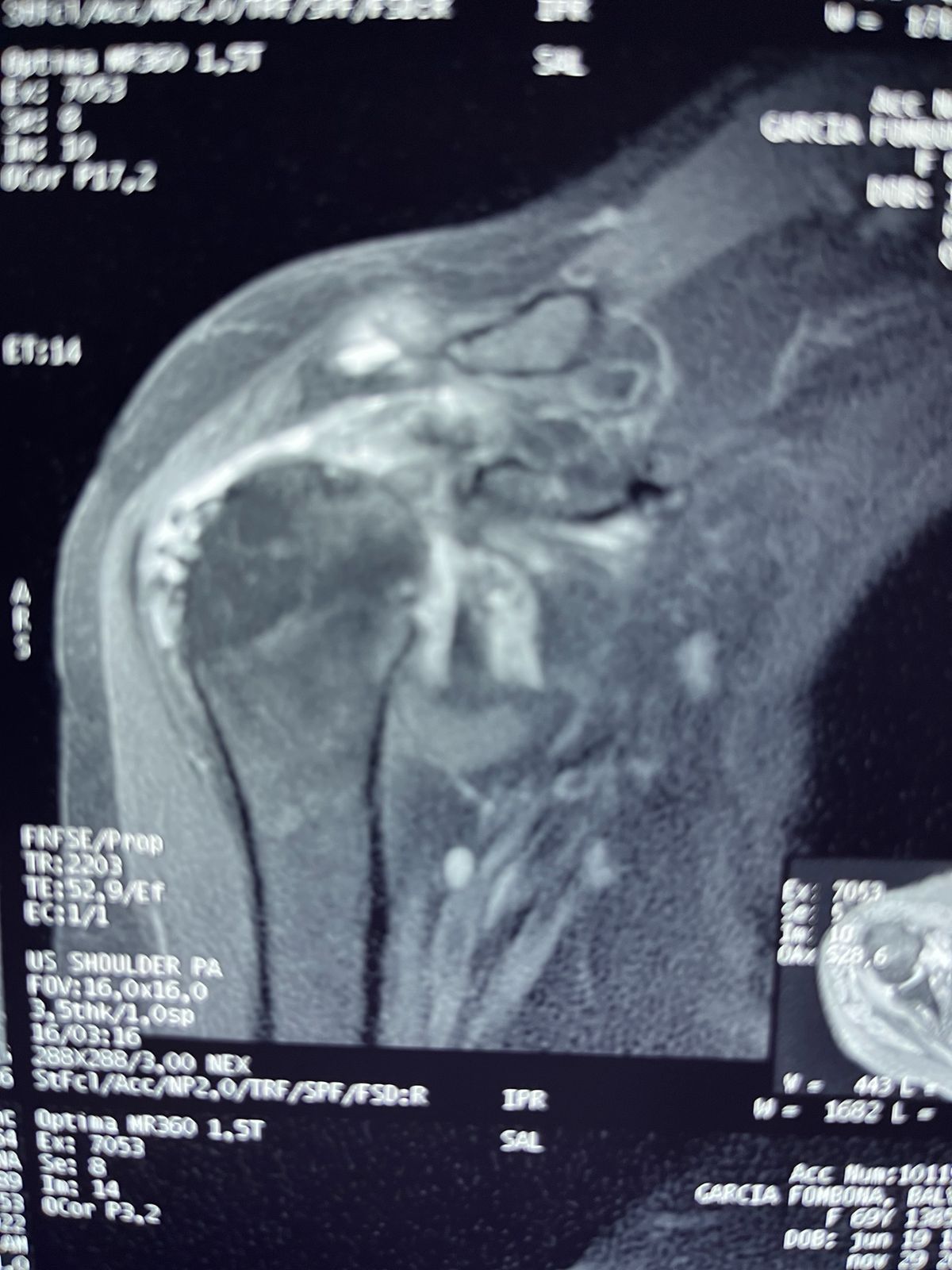 Ciro Arturo Estrada Malacon-1