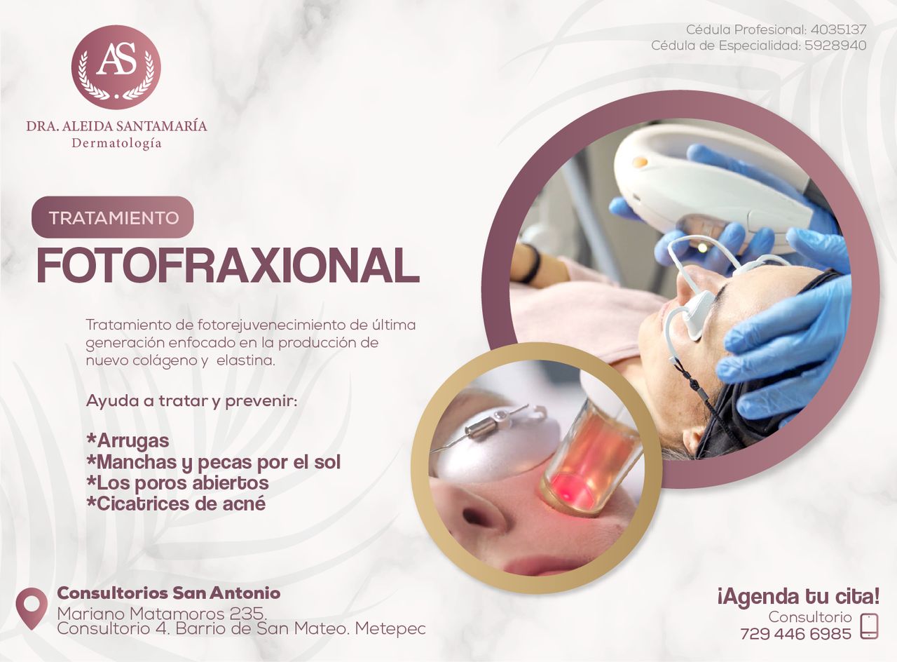 Aleida Santamaria Roman-6