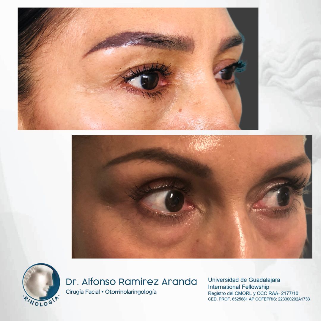 Alfonso Ramírez Aranda-8