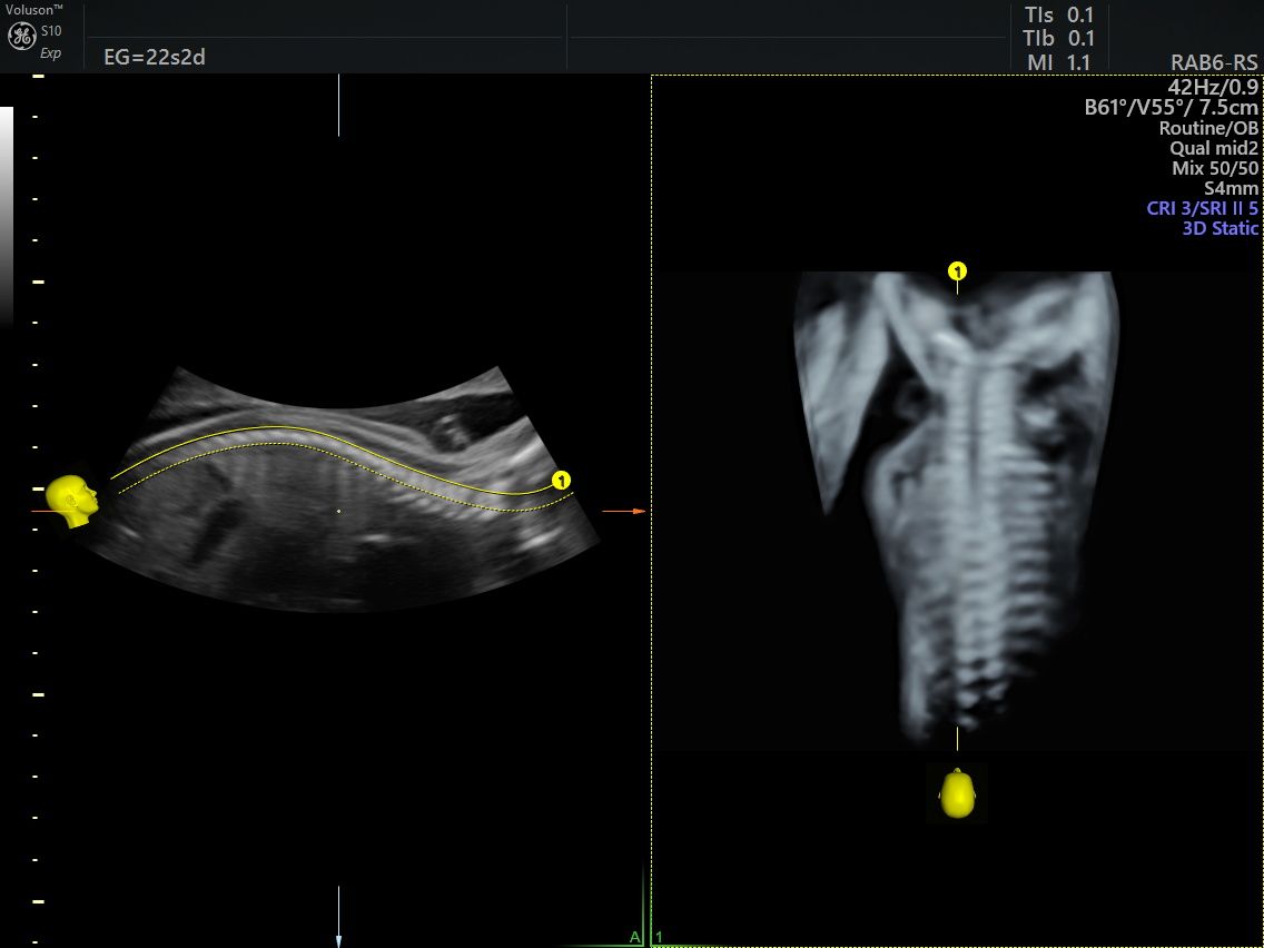 Juan Jose Pacheco Uc-11