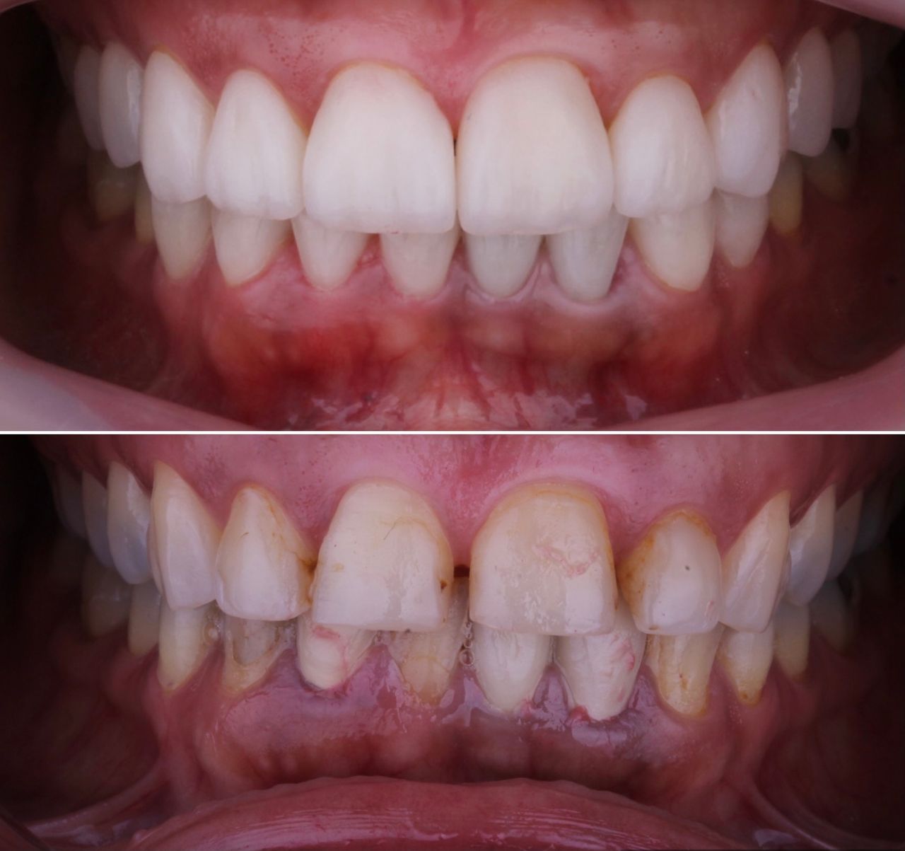 Josué Márquez Gómez-93