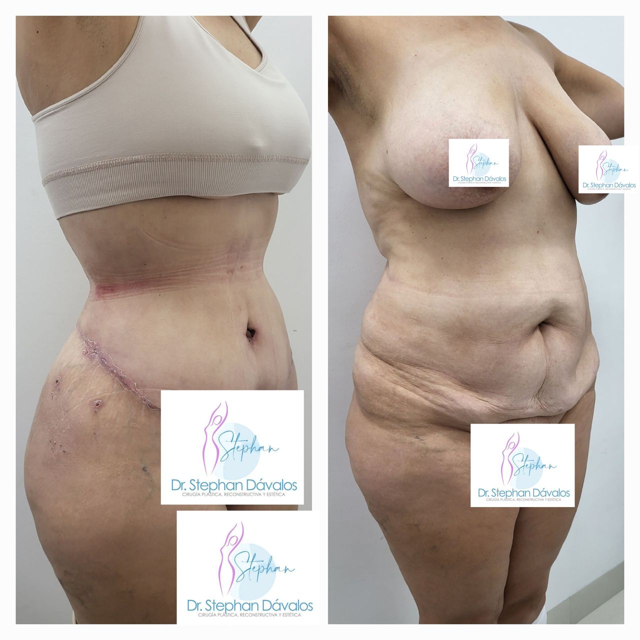 Stephan Dávalos Barrios-11