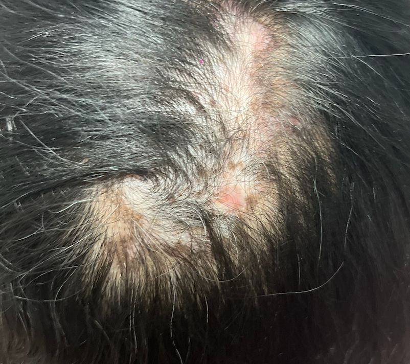 Lauro Francisco Varela Coronado-18