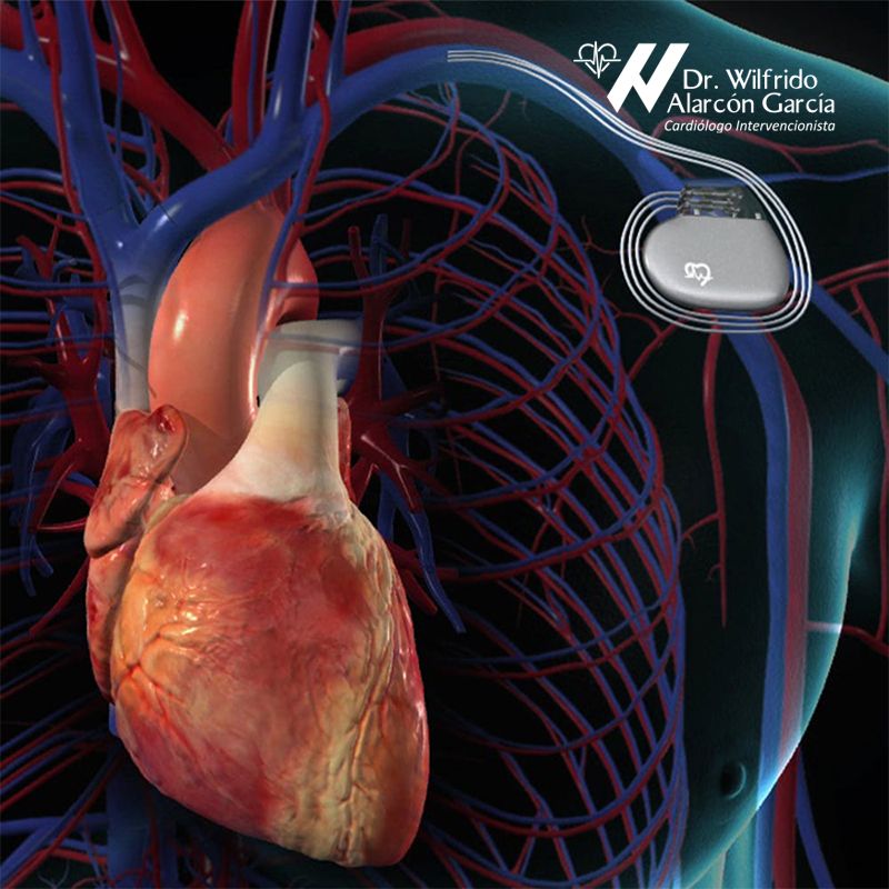 Wilfrido Alarcón García-3