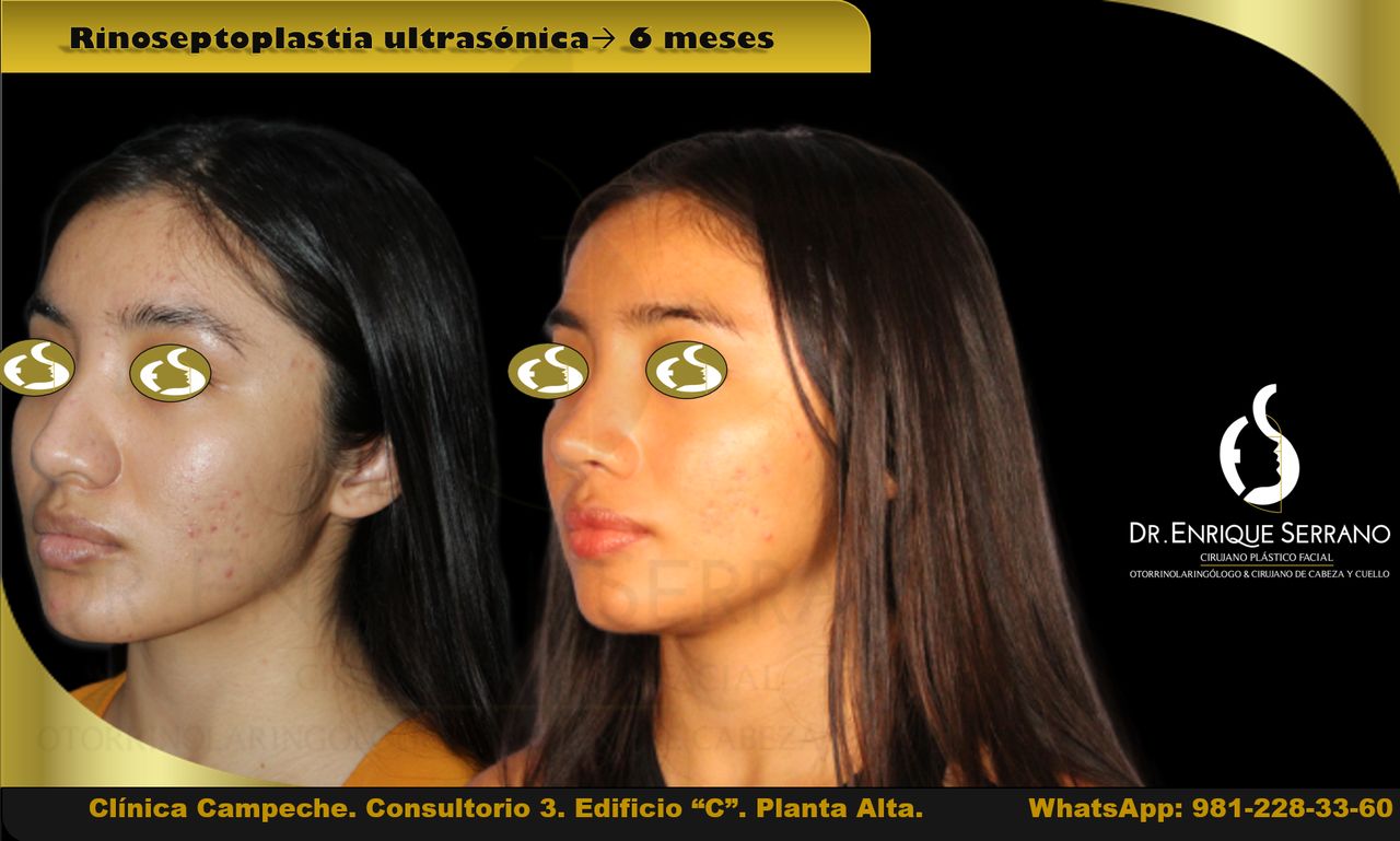 Enrique Serrano Cruz-32