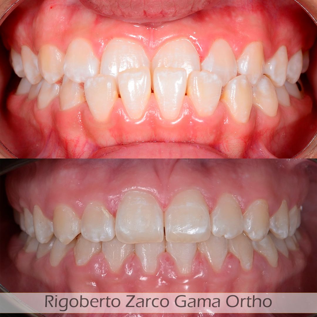 Rigoberto  Zarco Gama-6