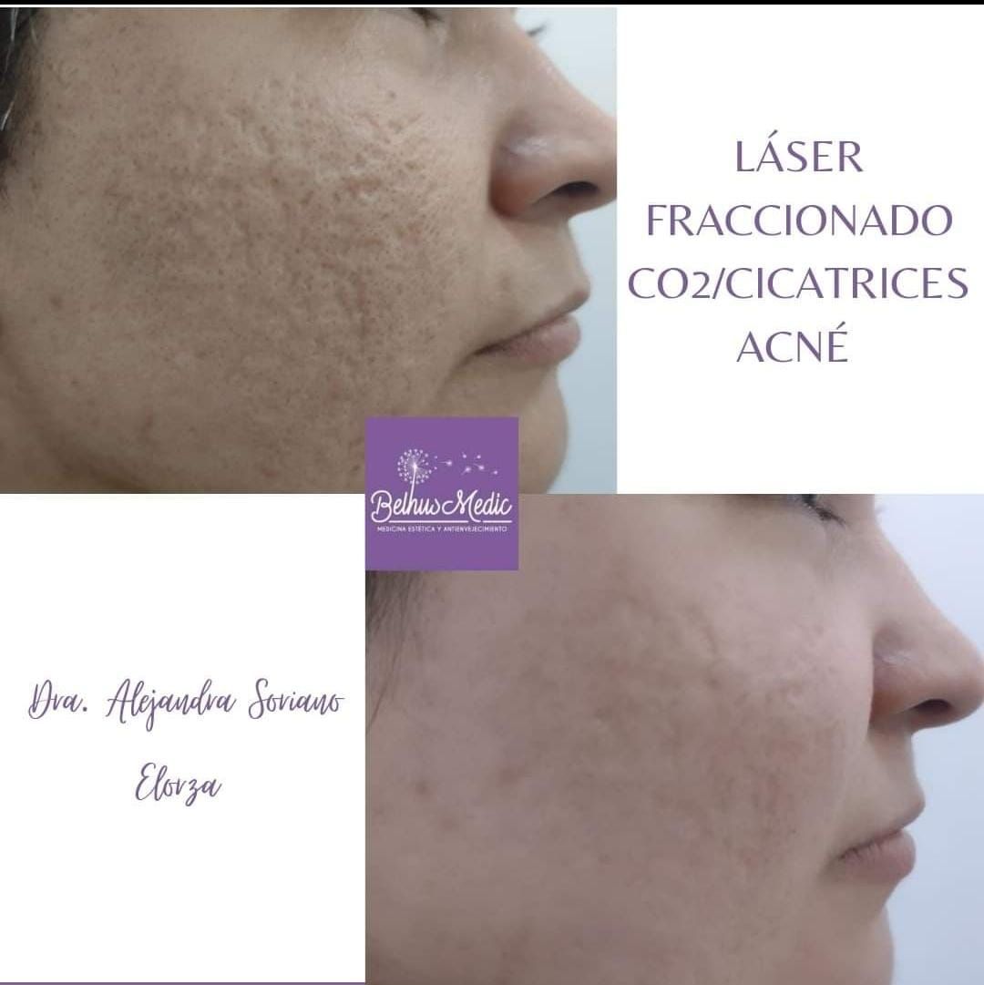 Alejandra Soriano Elorza-40