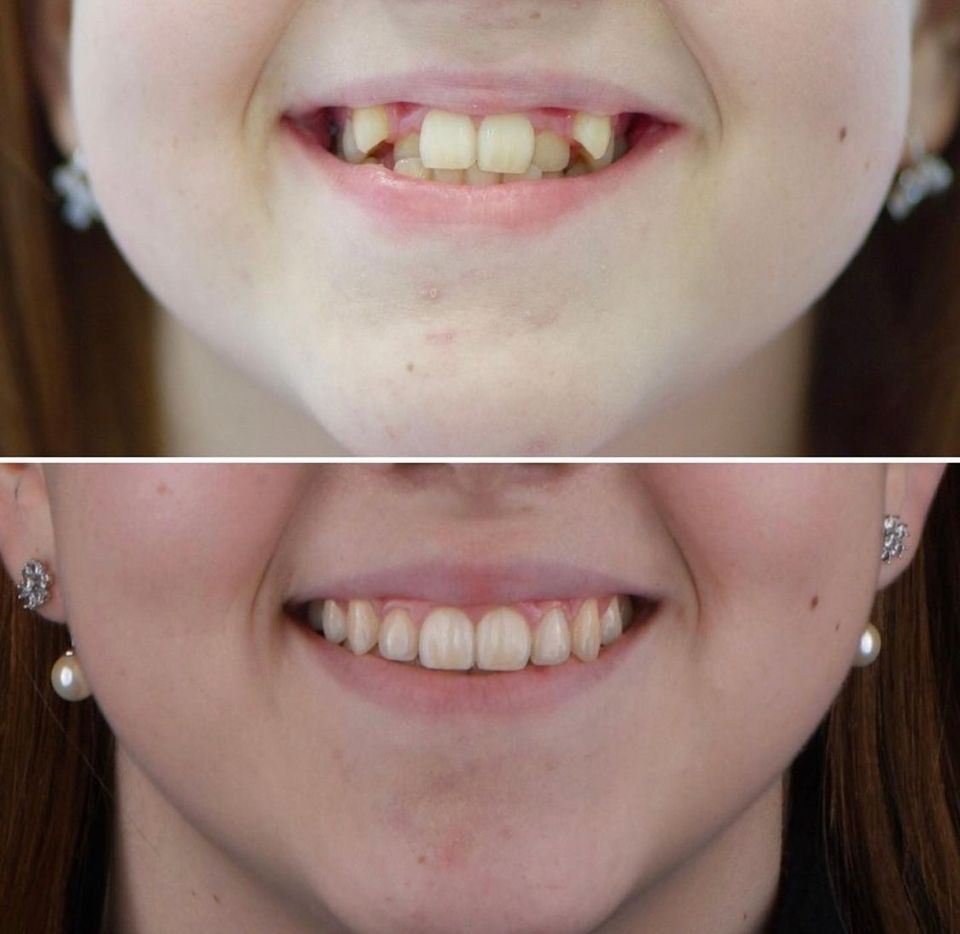 Francisco Alejandro Poblano Vázquez-1