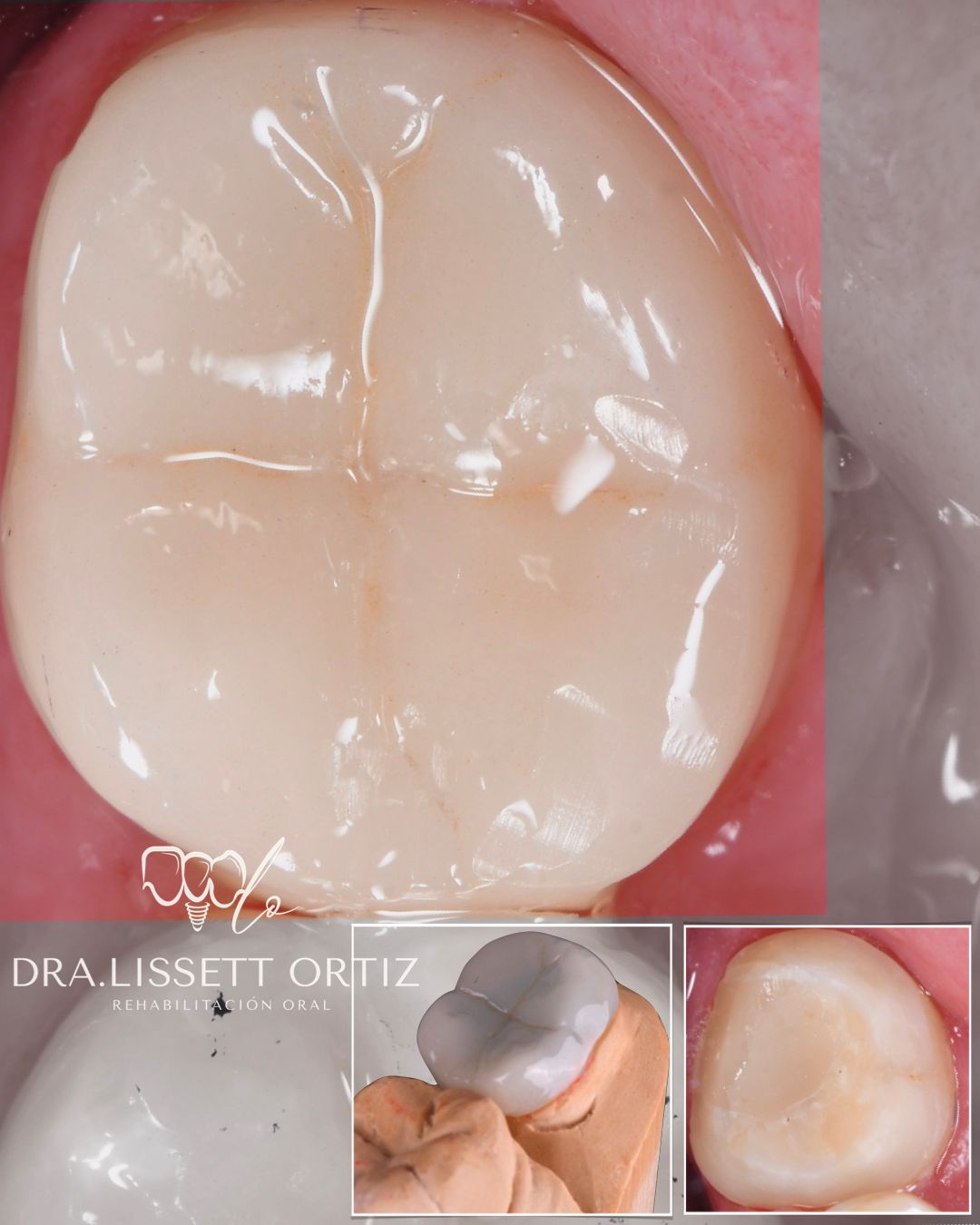 Ana Lissett Ortiz-32