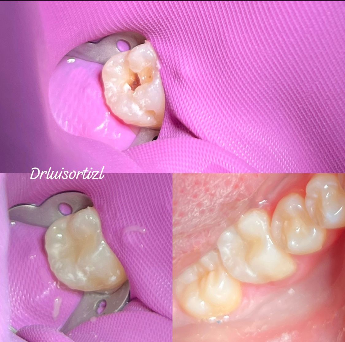 Luis Ángel Ortiz López-5