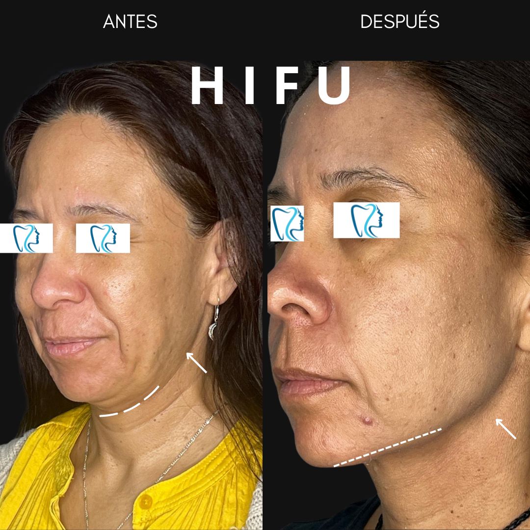 Consuelo Chapa Garza-5