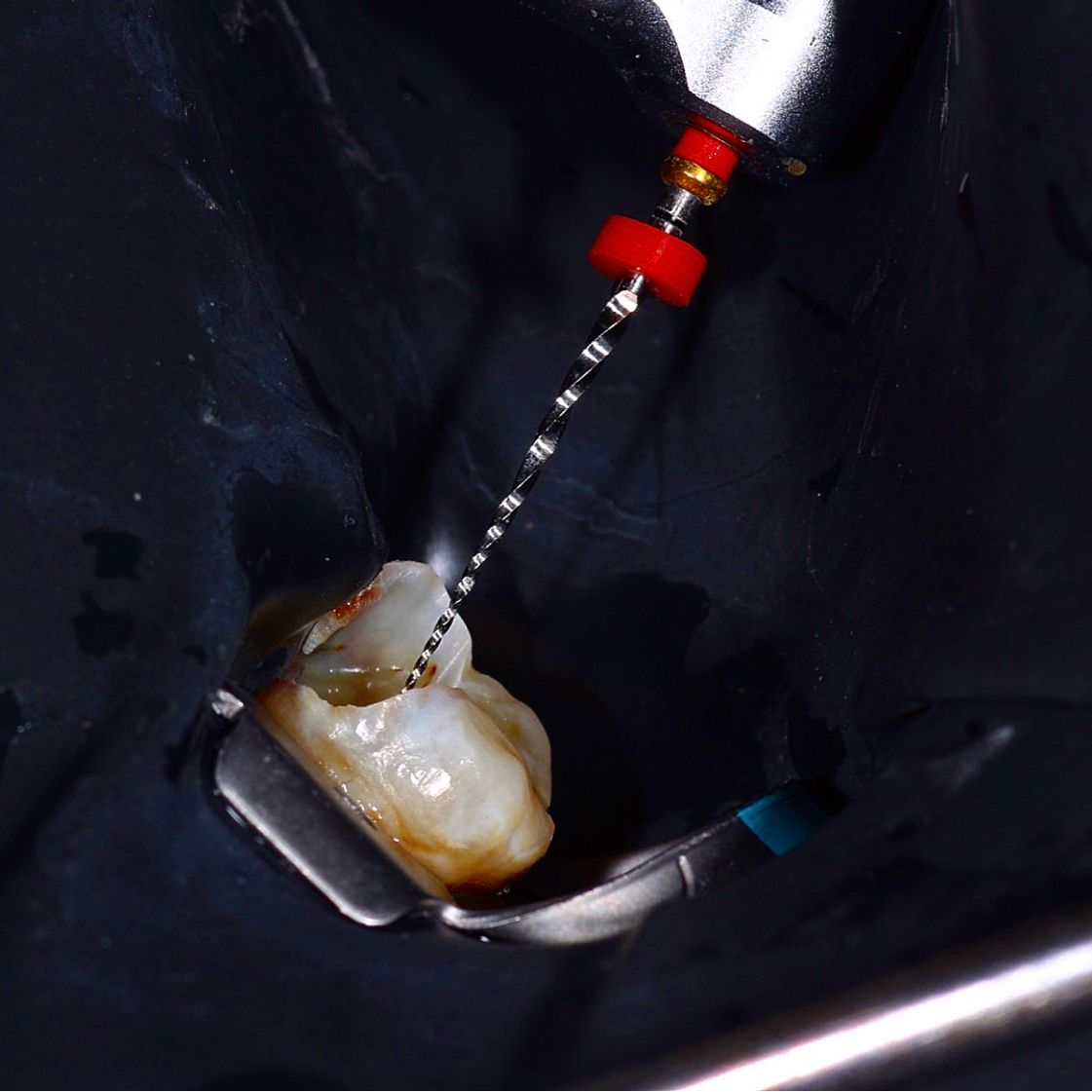 Angel Francisco Quiñones Mendoza-10