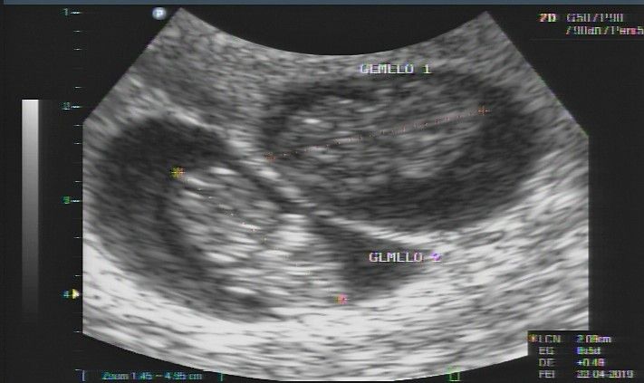 Mayi Mayret Mesquiti-27