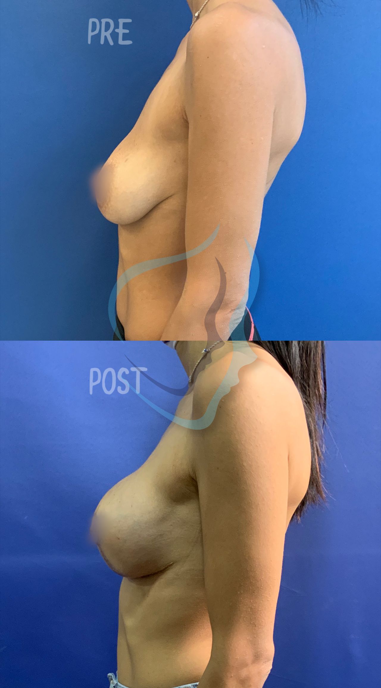 Giuseppe Tanzillo-68