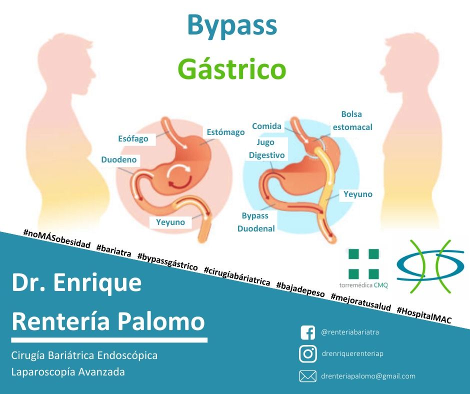 Enrique Rentería Palomo-43