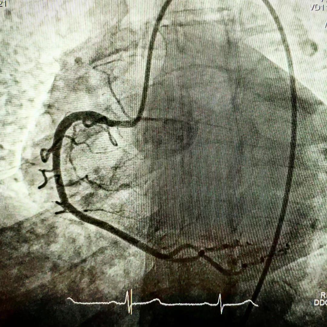 Miguel Angel Rojas Carrera-1